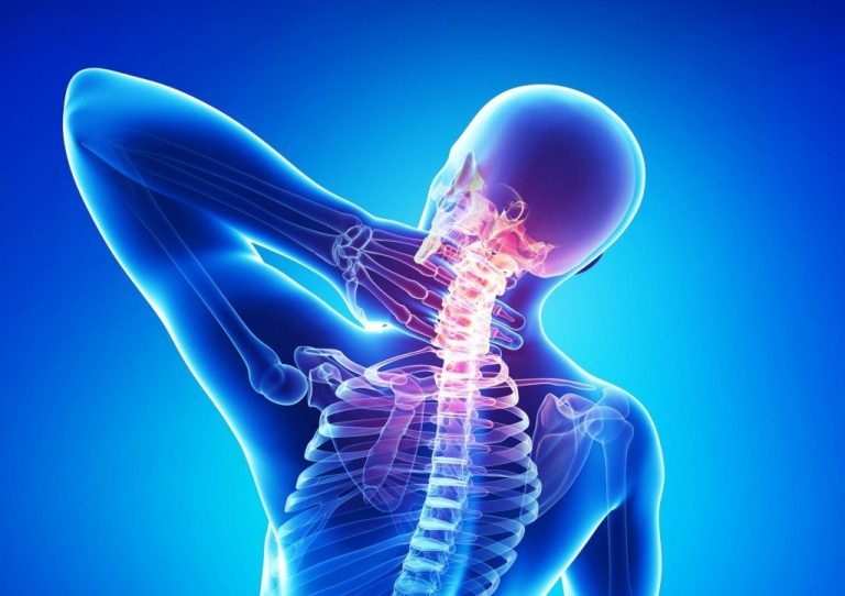 Osteoxondroz Haqqında Ətraflı Araşdırma: Səbəbləri