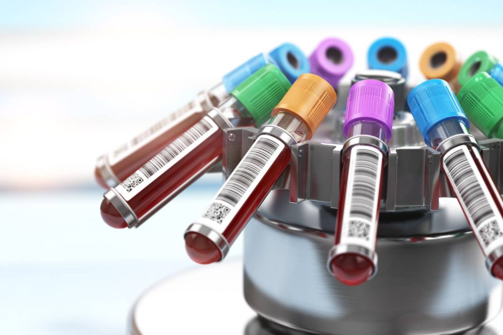 Immunoglobulin E ( IGE) : Diaqnostik Əhəmiyyəti, Müalicə yolu