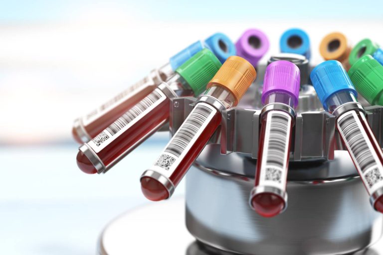Immunoglobulin E ( IGE) : Diaqnostik Əhəmiyyəti, Müalicə yolu