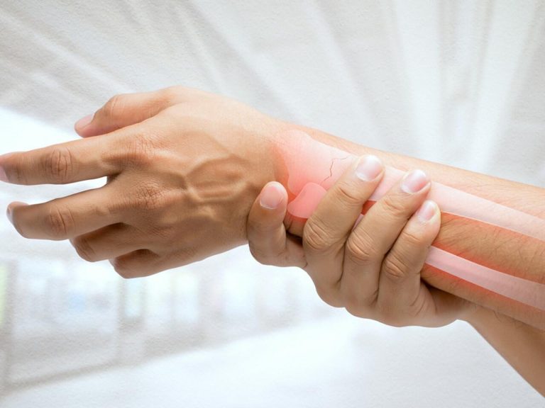 Əllərdə Uyuşma : Klinik Mənzərəsi, Səbəbləri
