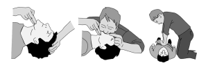 Cpr : Nədir? Hansı Hallarda Tətbiq Olunur?