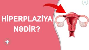 Hiperplaziya : Yaranma Səbəbləri, Növləri