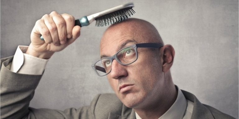 Keçəl: Psixoloji,Sosial Aspektləri