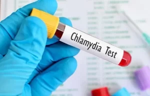 Xlamidiya Əlamətləri : Klinik Əlamətlərin Formalaşması, Kişilərdə Və Qadınlarda Bu Əlamətlər